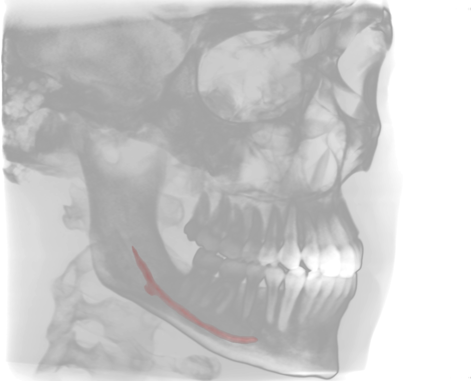 eVolDX Radiografia