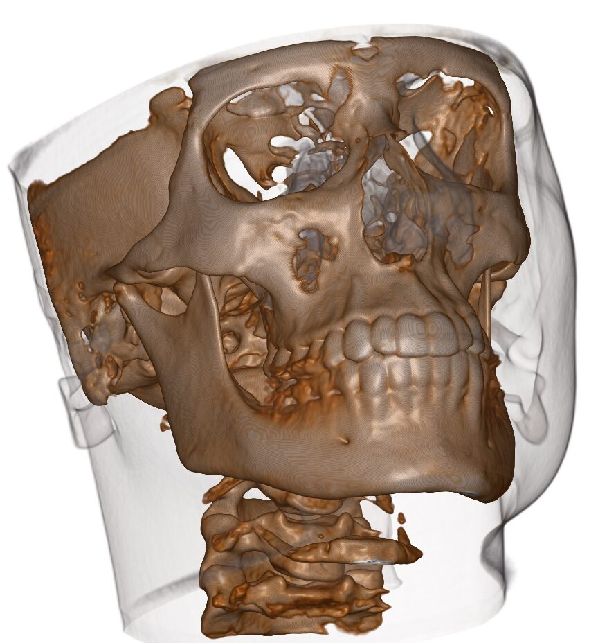 Radiologia 3D